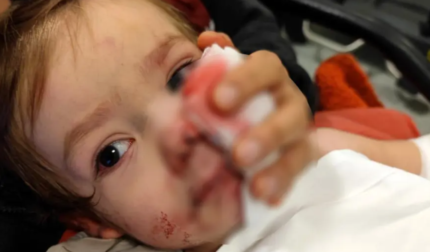 Pitbull saldırısına uğrayan minik Efe'den haber var