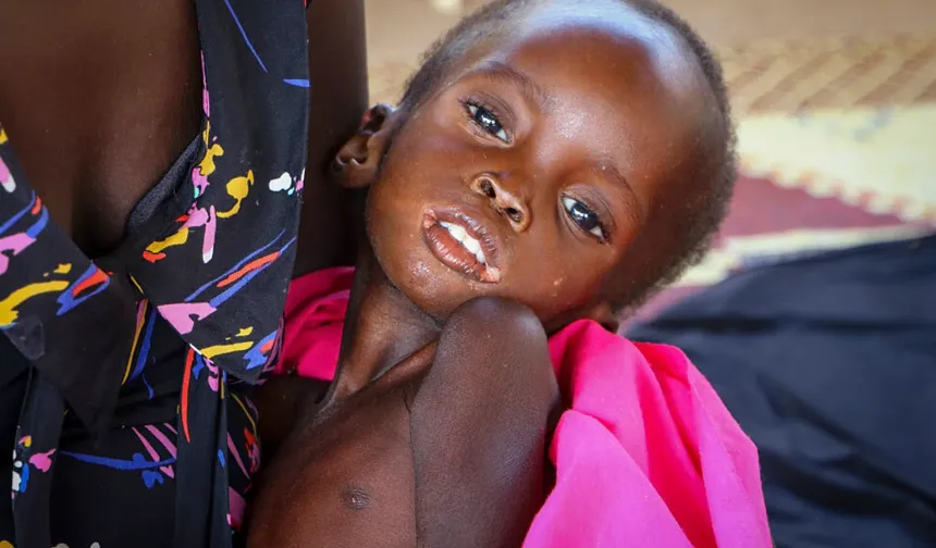 DSÖ: Sudan’da yetersiz beslenen çocuklar kolera ve kızamığa karşı daha savunmasız