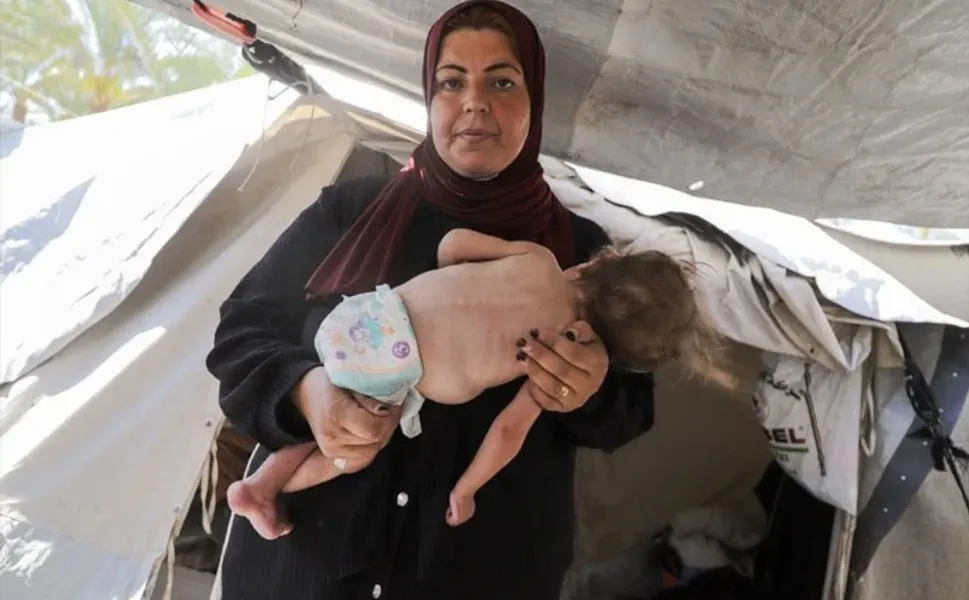 Gazze'de çocuklar hem açlık hem de hastalıkla mücadele ediyor