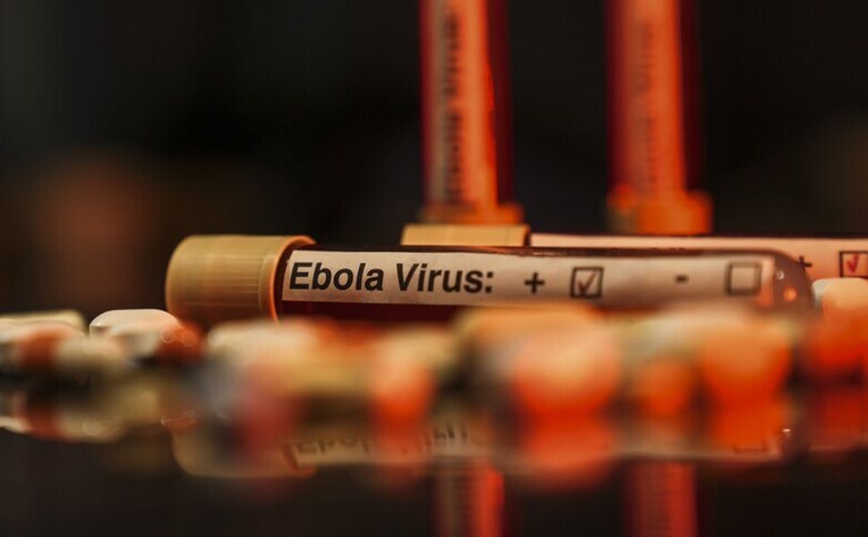 DSÖ, Uganda'da şimdiye kadar 19 Ebola virüsü vakasının görüldüğünü bildirdi