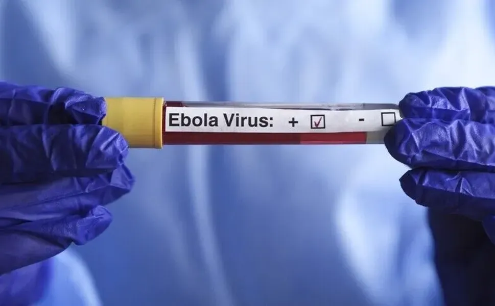 DSÖ'den Ebola salgını açıklaması: Seyahat kısıtlaması uygulanmamalı