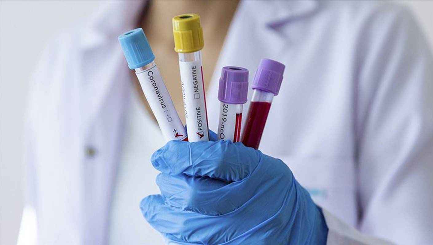 <h3>Koronavirüs (kovid-19) atlatan yeniden korona olur mu? Coronavirüs hastalığı ikinci kez bulaşır mı?</h3>
<p> </p>
<p>Covid-19'a yakalanan bir kişinin iyileştikten sonra hastalığa tekrar yakalanıp, yakalanmayacağı en çok merak edilen konulardan biri. Dünya genelindeki istatistiklere bakıldığında ikinci kez koronavirüse yakalananlar olmakla birlikte bu sayı oldukça düşük. Ancak bu risk kişilerin bağışıklık sistemi, maruz kaldıkları virüs oranı ve taşıdığı kronik hastalıklar gibi birçok detaya göre değişebilir. Tekrar görülen vakaların nedenleri arasında, virüsün sürekli olarak mutasyon geçiriyor olasının da etkisinin büyük olduğu düşünülüyor. Ancak gizemli virüsle ilgili net bilgiler elde edilebilmesi için henüz yeterli zaman geçmiş değil. </p>