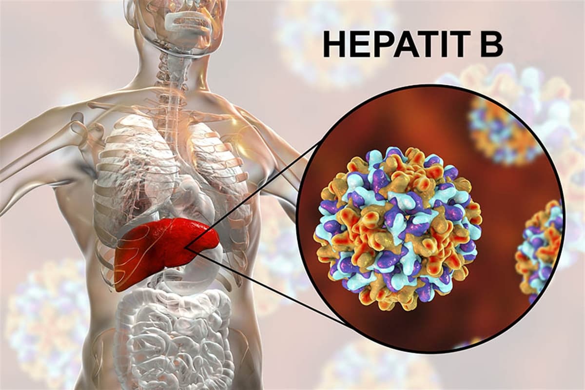 Hepatit B Tedavi Edilmezse Ne Olur Hangi Hastalığa Yol Açar