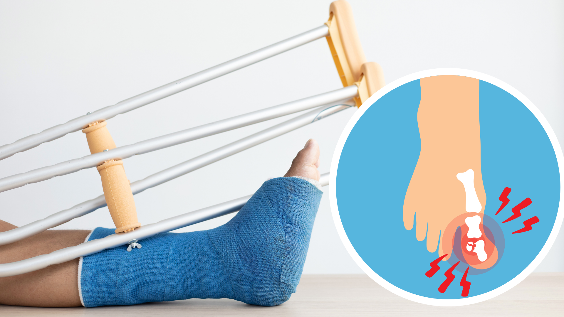 Kırıkların Iyileşmesinde Etkili Besinlerinler 2