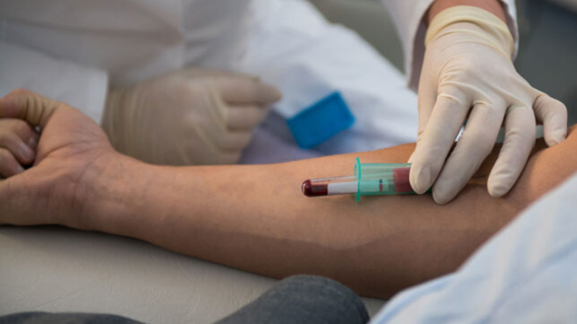 Alzheimer Blood Test