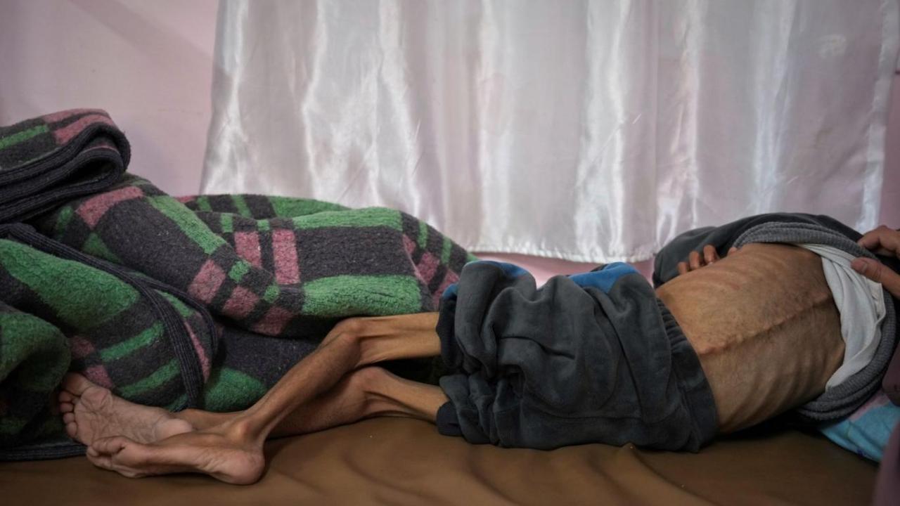 Gazze Aclik Cocuk Aa 2384728